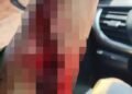 Karyawan Tambang di Kolaka Dianiaya, Polisi Periksa Saksi