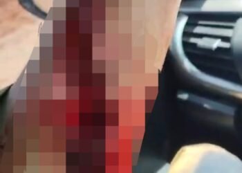 Karyawan Tambang di Kolaka Dianiaya, Polisi Periksa Saksi
