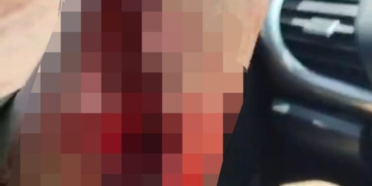 Karyawan Tambang di Kolaka Dianiaya, Polisi Periksa Saksi