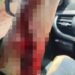 Karyawan Tambang di Kolaka Dianiaya, Polisi Periksa Saksi